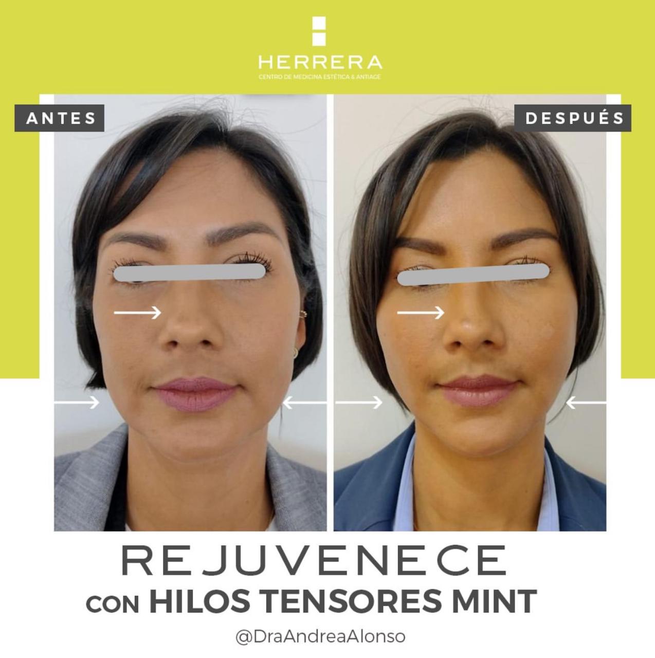 Testimonio 4