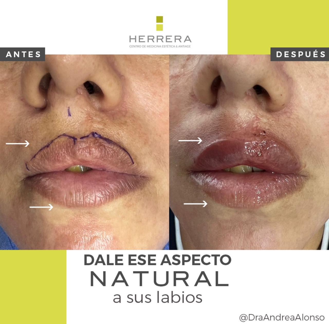 Testimonio 5